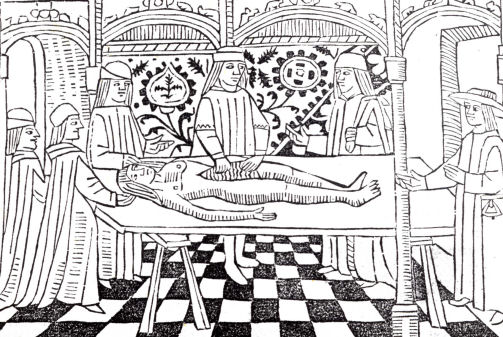 Leon d'anatomie au 15 sicle, Toulouse, Henri Mayer, 1494